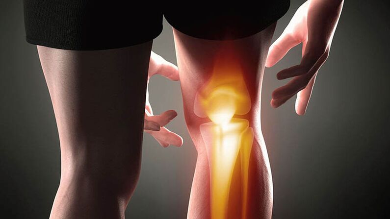 Kniegelenks -Osteoarthritis
